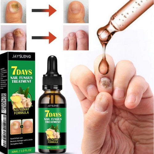 7 DAYS TRATAMIENTO PARA HONGOS UÑAS PIES Y MANOS (30 ML)